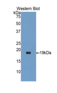Polyclonal Antibody to Procollagen C Proteinase Enhancer 2 (PCPE2)