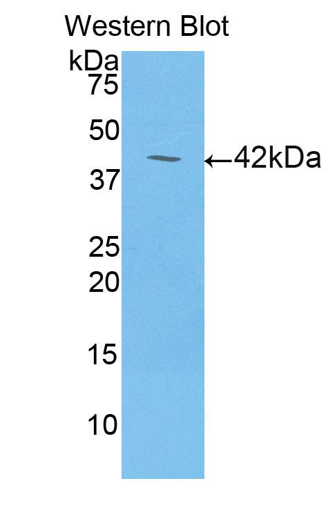 Polyclonal Antibody to Lipocalin 6 (LCN6)