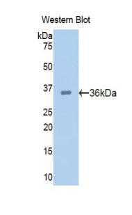 Polyclonal Antibody to Proprotein Convertase Subtilisin/Kexin Type 9 (PCSK9)