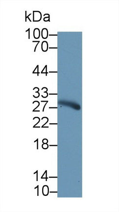 Polyclonal Antibody to Elastase 3A (ELA3A)