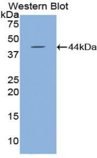 Polyclonal Antibody to Hyaluronoglucosaminidase 2 (HYAL2)