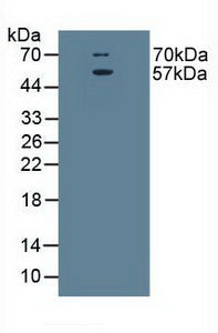 Polyclonal Antibody to Excitatory Amino Acid Transporter 3 (EAAT3)