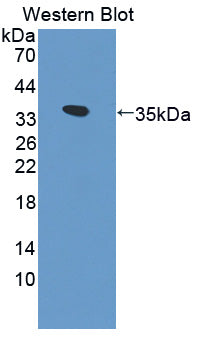 Polyclonal Antibody to Fyn Related Kinase (FRK)