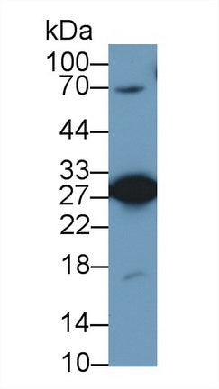 Polyclonal Antibody to Phosphoglycerate Mutase 1, Brain (PGAM1)