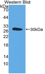 Polyclonal Antibody to Endothelial Cell Adhesion Molecule (ESAM)