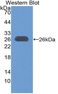 Polyclonal Antibody to B-Cell CLL/Lymphoma 9 (Bcl9)