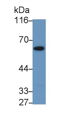 Polyclonal Antibody to Cyclin Dependent Kinase 16 (CDK16)