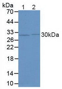 Polyclonal Antibody to FK506 Binding Protein 5 (FKBP5)