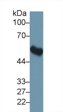 Polyclonal Antibody to FK506 Binding Protein 5 (FKBP5)