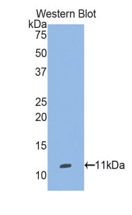 Polyclonal Antibody to Selenoprotein W1 (SEPW1)