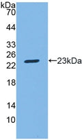Polyclonal Antibody to Sphingosine 1 Phosphate Lyase 1 (SGPL1)