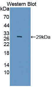 Polyclonal Antibody to Inhibitory Subunit Of NF Kappa B Epsilon (IkBe)