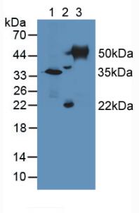 Polyclonal Antibody to Tubulin Delta (TUBd)