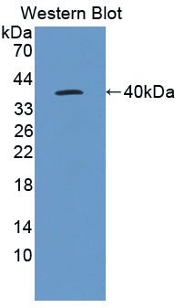 Polyclonal Antibody to Interleukin 22 Receptor (IL22R)
