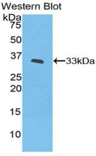 Polyclonal Antibody to Interleukin 20 Receptor Beta (IL20Rb)