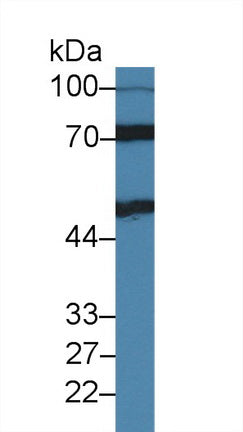 Polyclonal Antibody to Interleukin 11 Receptor Alpha (IL11Ra)