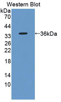 Polyclonal Antibody to A Kinase Anchor Protein 12 (AKAP12)