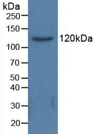 Polyclonal Antibody to Histone Deacetylase 6 (HDAC6)
