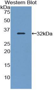 Polyclonal Antibody to Filamin B Beta (FLNb)