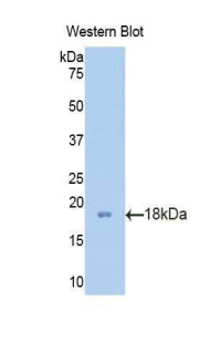 Polyclonal Antibody to Profilin 2 (PFN2)