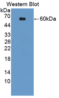 Polyclonal Antibody to Ubiquitin Specific Peptidase 14 (USP14)