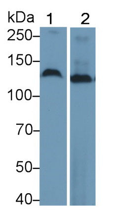 Polyclonal Antibody to Ubiquitin Specific Peptidase 8 (USP8)