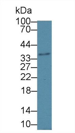 Polyclonal Antibody to 17-Beta-Hydroxysteroid Dehydrogenase Type 12 (HSD17b12)