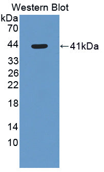 Polyclonal Antibody to 11-Beta-Hydroxysteroid Dehydrogenase Type 2 (HSD11b2)