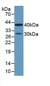Polyclonal Antibody to Carboxypeptidase A4 (CPA4)