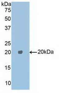 Polyclonal Antibody to Carboxypeptidase E (CPE)