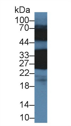 Polyclonal Antibody to Crystallin Beta B1 (CRYbB1)