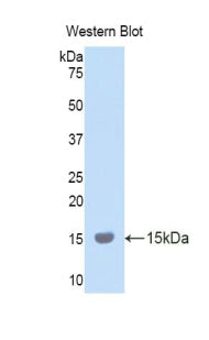 Polyclonal Antibody to Lysyl Oxidase Like Protein 2 (LOXL2)
