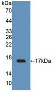 Polyclonal Antibody to Uroplakin 2 (UPK2)