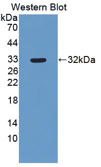 Polyclonal Antibody to 2',5'-Oligoadenylate Synthetase Like Protein (OASL)