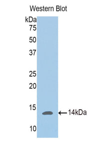 Polyclonal Antibody to Phosphoglucomutase 5 (PGM5)
