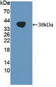 Polyclonal Antibody to Transient Receptor Potential Cation Channel Subfamily A, Member 1 (TRPA1)