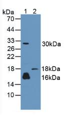 Polyclonal Antibody to Calmodulin Like Protein 3 (CALML3)