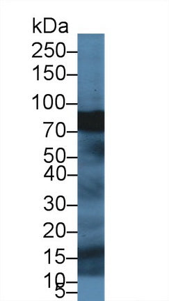Polyclonal Antibody to Spectrin Beta, Non Erythrocytic 4 (SPTbN4)