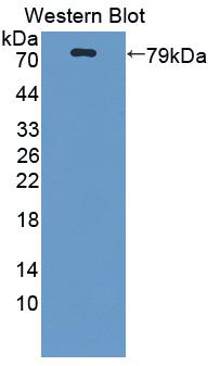 Polyclonal Antibody to Protoporphyrinogen Oxidase (PPOX)