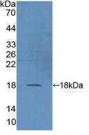 Polyclonal Antibody to Dual Specificity Phosphatase 5 (DUSP5)