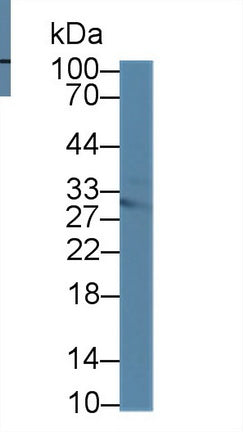 Polyclonal Antibody to Methylthioadenosine Phosphorylase (MTAP)