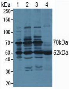 Polyclonal Antibody to Proteasome 26S Subunit, ATPase 3 (PSMC3)
