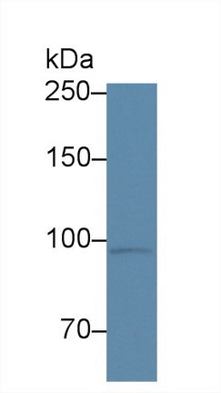 Polyclonal Antibody to Corin (CRN)