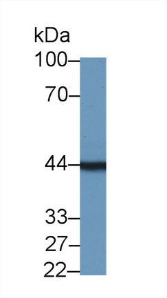 Polyclonal Antibody to Tropomodulin 3 (TMOD3)
