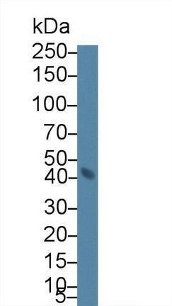 Polyclonal Antibody to Transcobalamin II, Macrocytic Anemia (TCN2)