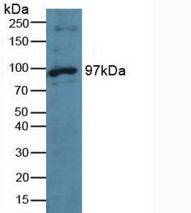 Polyclonal Antibody to TTK Protein Kinase (TTK)