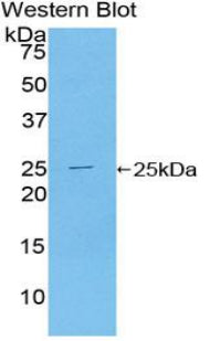Polyclonal Antibody to Toll Like Receptor Adaptor Molecule 2 (TICAM2)