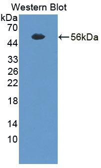 Polyclonal Antibody to Trans Golgi Network Protein 2 (TGOLN2)