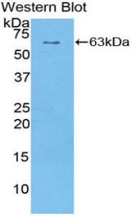Polyclonal Antibody to Sulfatase 1 (SULF1)