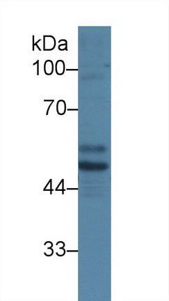 Polyclonal Antibody to Serine/Threonine Kinase 11 (STK11)